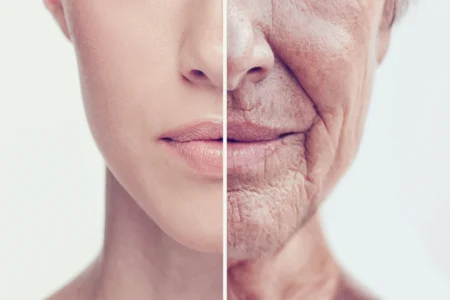 Anti-Aging Treatment