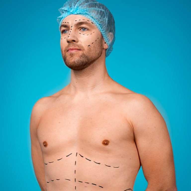 Male-abdomen-HD-liposculpture