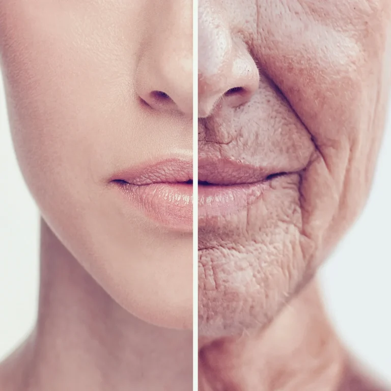 Anti-Aging Treatment